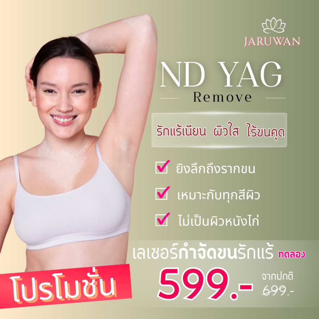 โปรแกรมเลเซอร์ขน